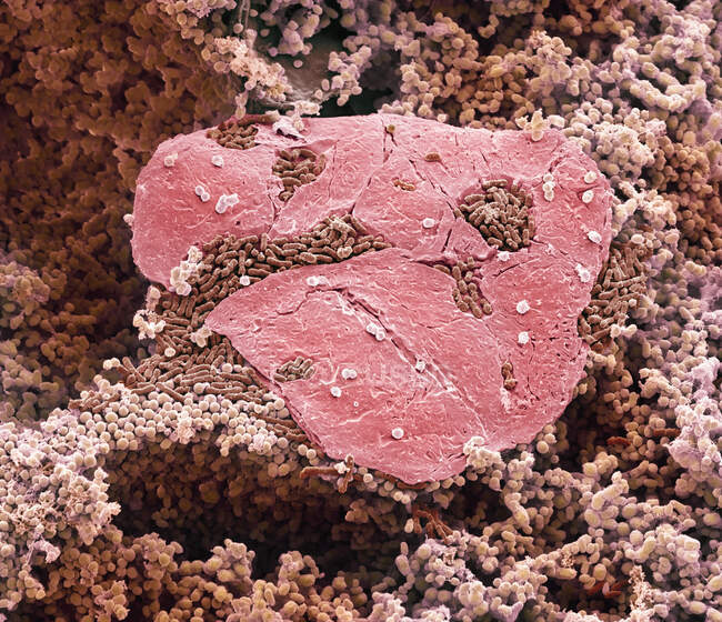 Des bactéries des pieds. Micrographie électronique à balayage coloré (MEB) de bactéries cultivées entre les orteils du pied — Photo de stock