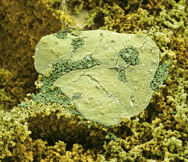 Des bactéries des pieds. Micrographie électronique à balayage coloré (MEB) de bactéries cultivées entre les orteils du pied — Photo de stock