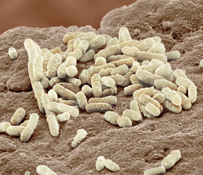 Кольоровий скануючий електронний мікрограф у формі палички, грам-негативних бактерій Escherichia coli, широко відомий як E. coli. — стокове фото