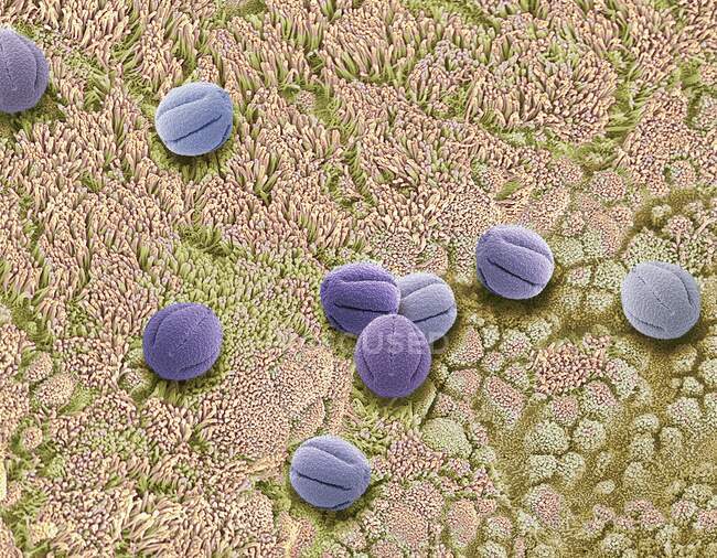 Составное изображение носового эпителия и пыльцы. Цветной сканирующий электронный микрограф (СЭМ) поверхности носового эпителия с вдыханием пыльцы. — стоковое фото