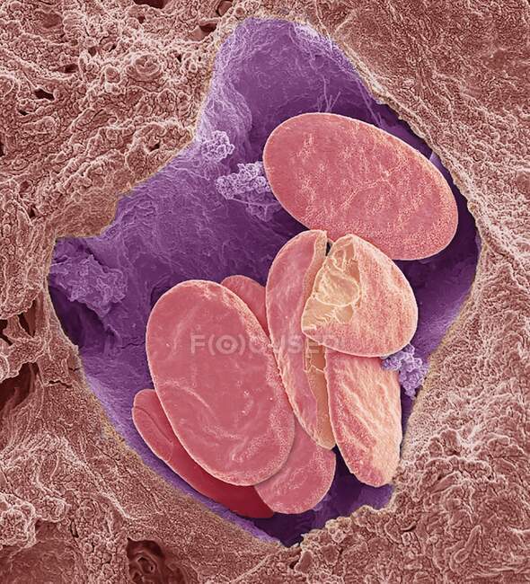 Glóbulos rojos de serpiente. Micrografía electrónica de barrido de color (SEM) de los glóbulos rojos (eritrocitos, rojos) enteros y fracturados en un pequeño vaso sanguíneo de una serpiente - foto de stock