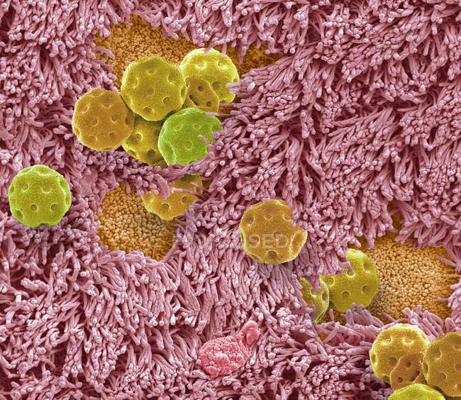Imagem composta de epitélio nasal e pólen. Micrografia eletrônica de varredura colorida (MEV) da superfície do epitélio nasal com inalação em pólen. — Fotografia de Stock