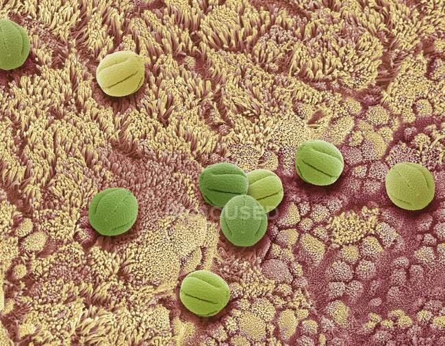 Zusammengesetztes Bild von Nasenepithel und Pollen. Farbige Rasterelektronenmikroskopie (REM) der Oberfläche des Nasenepithels mit eingeatmeten Pollen. — Stockfoto