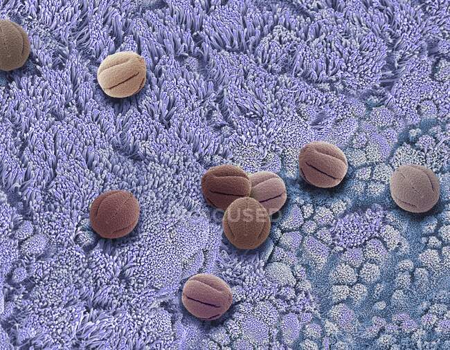 Imagen compuesta de epitelio nasal y polen. Micrografía electrónica de barrido coloreada (SEM) de la superficie del epitelio nasal con polen inhalado. - foto de stock