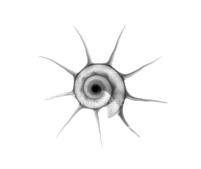 Turbante estrela triunfante (Guildfordia triunphans), raio-X. — Fotografia de Stock