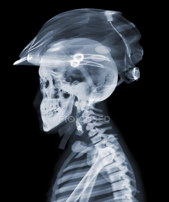 Rider with cycle helmet, X-ray — Stock Photo