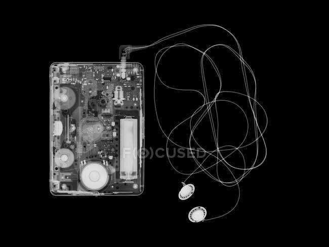 Walkman cassete, raio-X — Fotografia de Stock