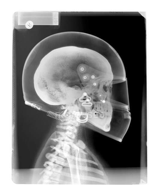 Caveira e capacete, raio-X. — Fotografia de Stock