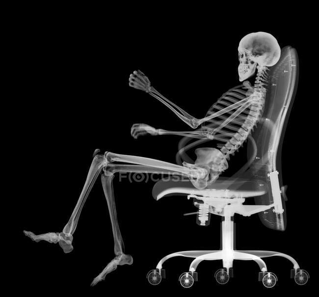 Squelette dans une chaise de bureau, radiographie. — Photo de stock