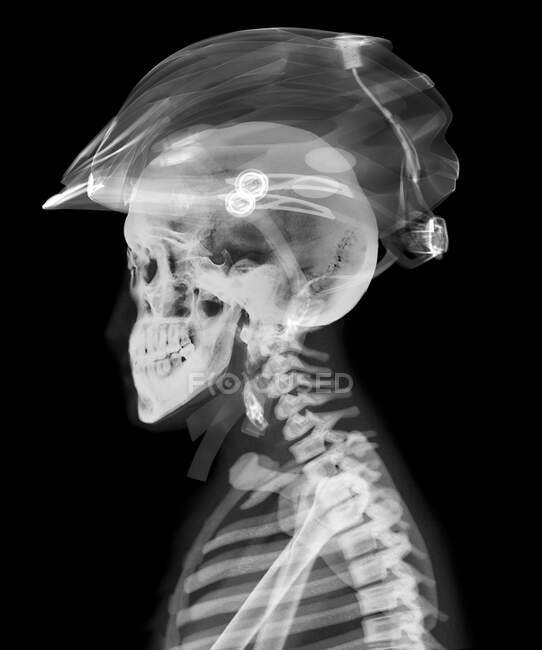 Skull and helmet, X-ray. — Stock Photo