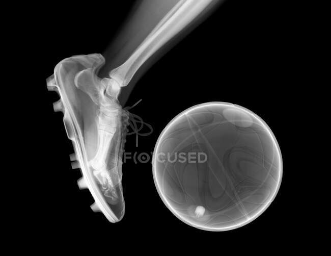 Player in action kicking a football, X-ray. — Stock Photo