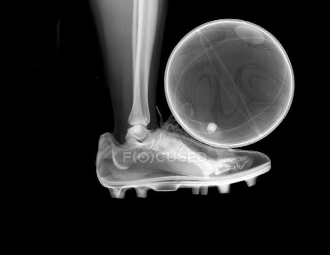 Jogador em ação chutando um futebol, raio-X. — Fotografia de Stock