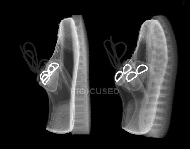Sapatos, raio-X, radiologia scan — Fotografia de Stock