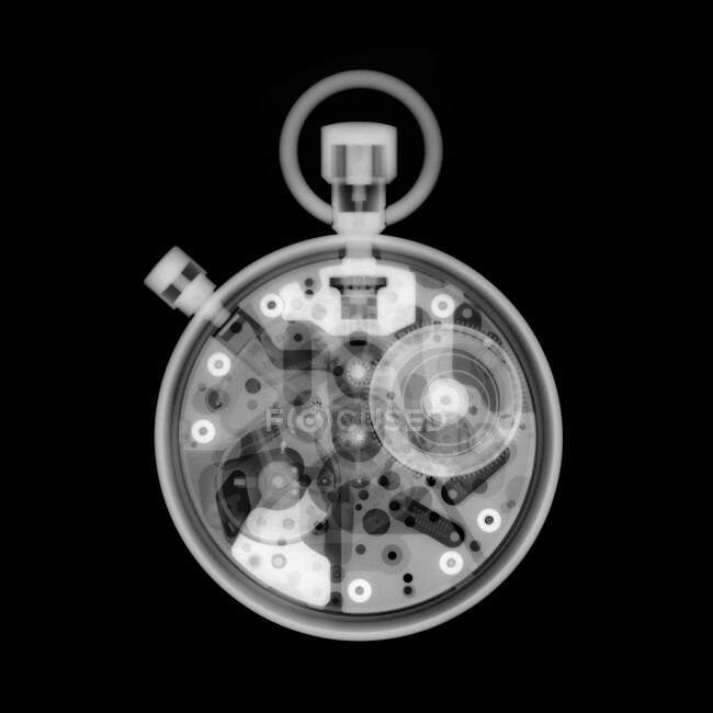 Годинник, рентген, радіологічне сканування — стокове фото