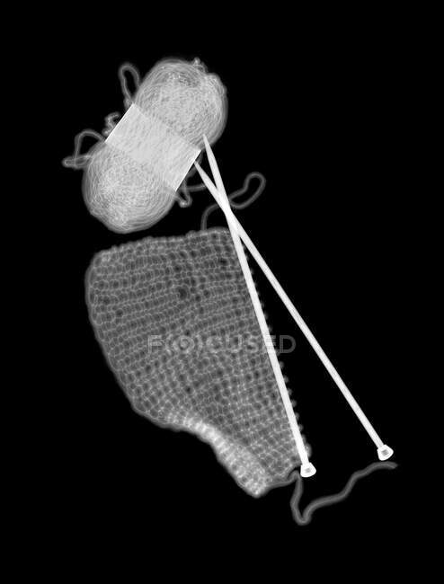 Knitting, X-ray, radiology scan — Stock Photo