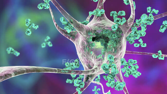 Anticuerpos atacando neuronas. Ilustración computacional conceptual de enfermedades neurológicas autoinmunes - foto de stock