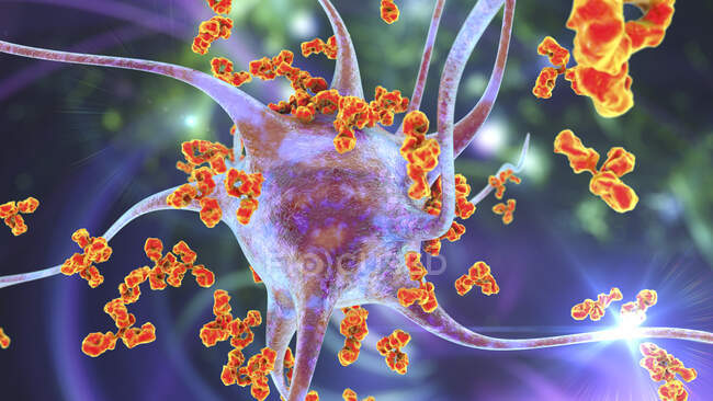 Антитіла атакують нейрони. Концептуальна комп'ютерна ілюстрація аутоімунних неврологічних захворювань — стокове фото