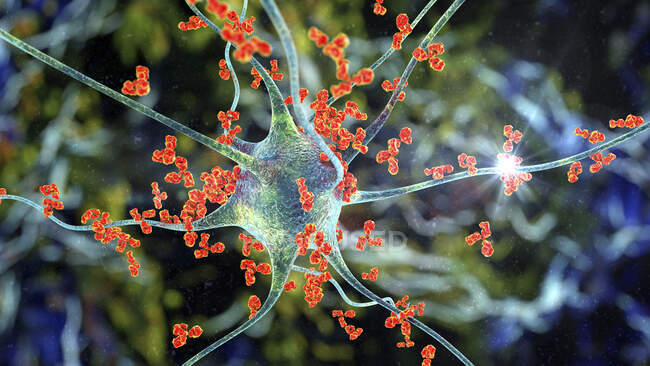 Антитіла атакують нейрони. Концептуальна комп'ютерна ілюстрація аутоімунних неврологічних захворювань — стокове фото