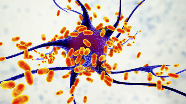 Bakterielle Enzephalitis. Konzeptionelle Computerillustration zeigt Bakterien, die Gehirnzellen infizieren — Stockfoto
