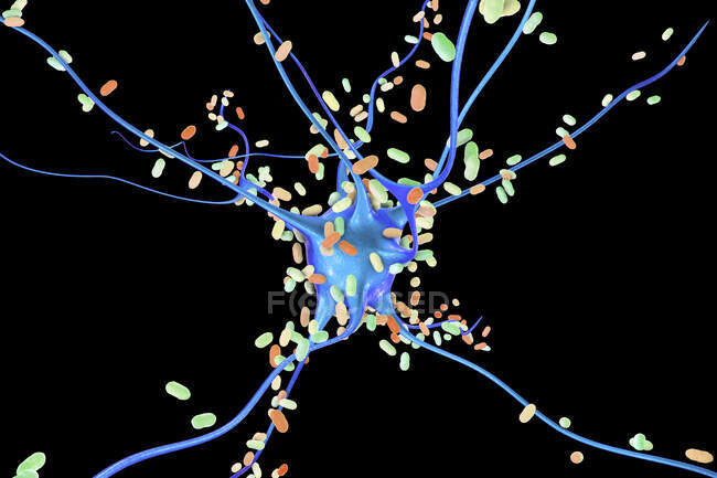 Бактериальный энцефалит. Концептуальная компьютерная иллюстрация, показывающая бактерии, поражающие клетки мозга — стоковое фото