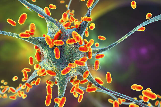 Бактеріальний енцефаліт. Концептуальна комп'ютерна ілюстрація, що показує бактерії, що заражають клітини мозку — стокове фото