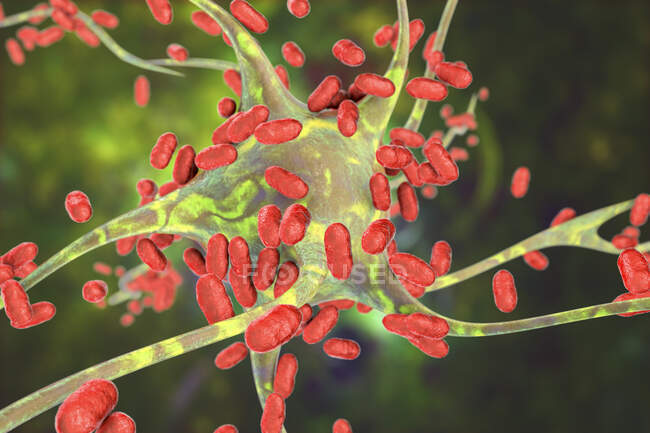 Encefalite bacteriana. Ilustração conceitual do computador mostrando bactérias infectando células cerebrais — Fotografia de Stock