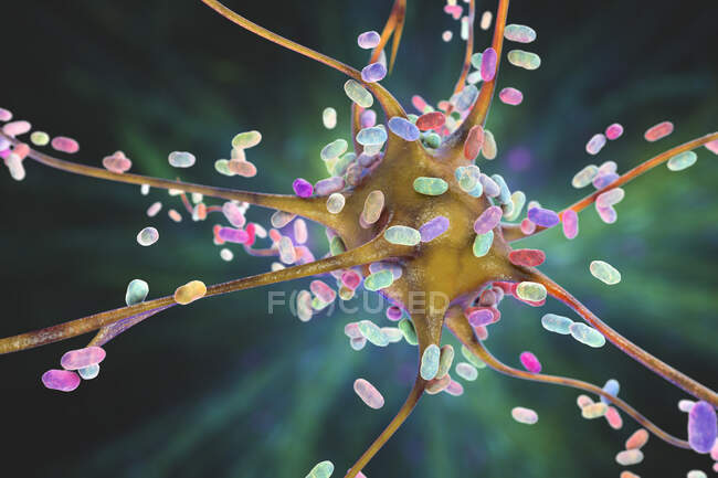 Bacterial encephalitis. Conceptual computer illustration showing bacteria infecting brain cells — Stock Photo