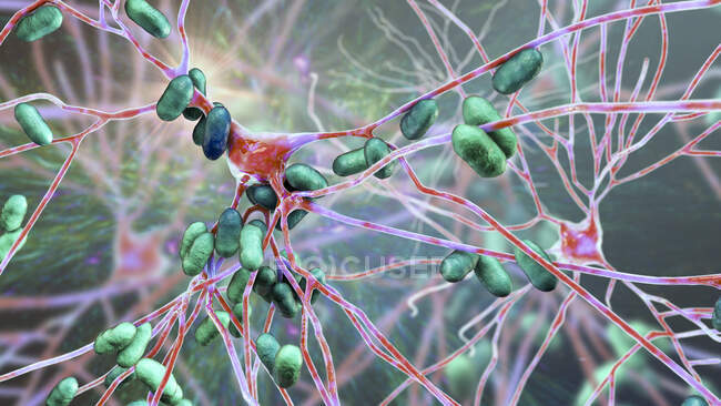 Бактеріальний енцефаліт. Концептуальна комп'ютерна ілюстрація показує, що бактерії інфікують клітини мозку. — стокове фото