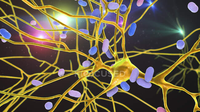 Бактеріальний енцефаліт. Концептуальна комп'ютерна ілюстрація показує, що бактерії інфікують клітини мозку. — стокове фото