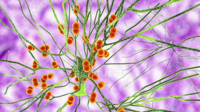Бактеріальна інфекція мозку. Концептуальна комп'ютерна ілюстрація, що показує бактерії Streptococcus pneumoniae, одна з основних причин бактеріального менінгіту та менінгоенцефаліту, що заражають клітини мозку — стокове фото