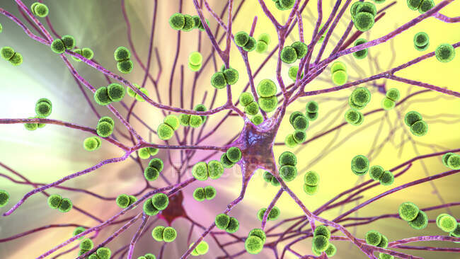 Бактеріальна інфекція мозку. Концептуальна комп'ютерна ілюстрація показує бактерію Streptococcus pneumoniae, одну з головних причин бактеріального менінгіту та менінгоенцефаліту, що інфікує клітини мозку. — стокове фото
