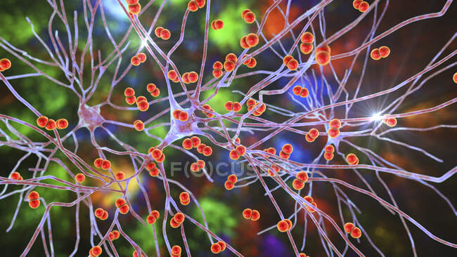 Бактеріальна інфекція мозку. Концептуальна комп'ютерна ілюстрація показує бактерію Streptococcus pneumoniae, одну з головних причин бактеріального менінгіту та менінгоенцефаліту, що інфікує клітини мозку. — стокове фото