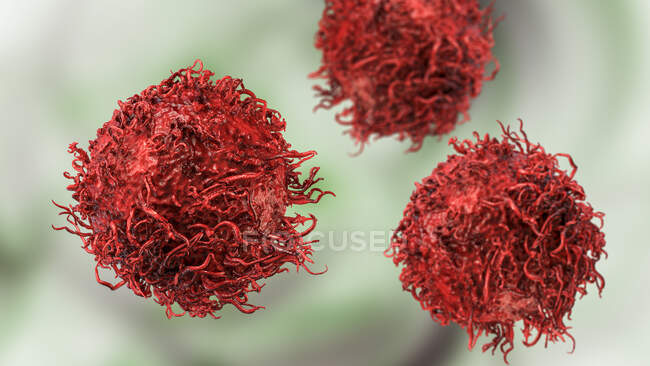 Stomach cancer cell, computer illustration — Stock Photo