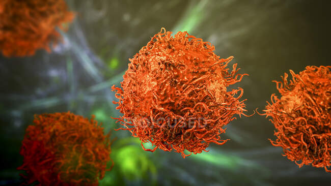Клітина раку шлунка, комп'ютерна ілюстрація. — стокове фото