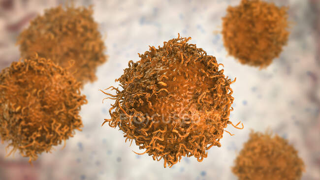 Célula de cáncer de estómago, ilustración por computadora - foto de stock