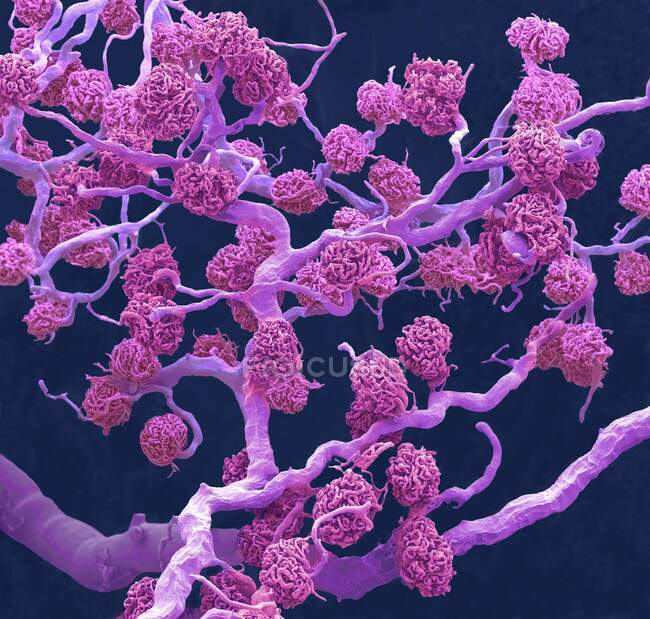 Glomérulos renais. Micrografia eletrônica de varredura colorida (MEV) de um molde de resina de capilares de glomérulos e os vasos sanguíneos maiores que lhes fornecem sangue — Fotografia de Stock