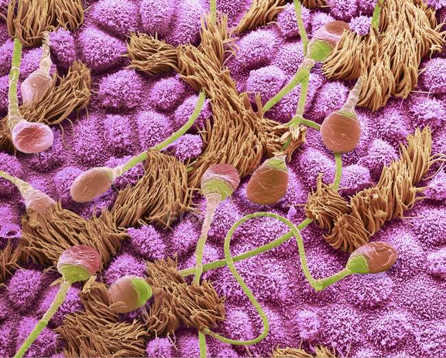 Sperma in una tuba di Falloppio. Micrografo elettronico a scansione a composizione colorata (SEM) di spermatozoi umani che attraversano una tuba di Falloppio (ovidotto) di una femmina — Foto stock
