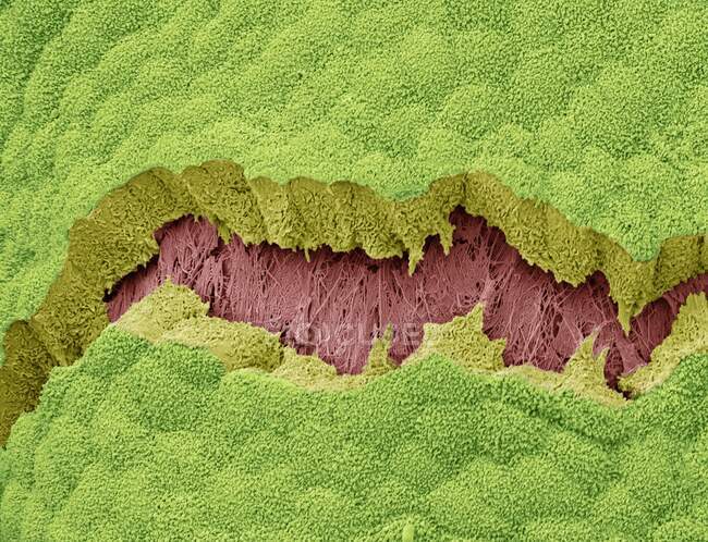La cistifellea. Micrografo elettronico a scansione colorata (SEM) della superficie di una cistifellea. Questo rivestimento mucosa è costituito da cellule epiteliali cuboidali (verde) — Foto stock