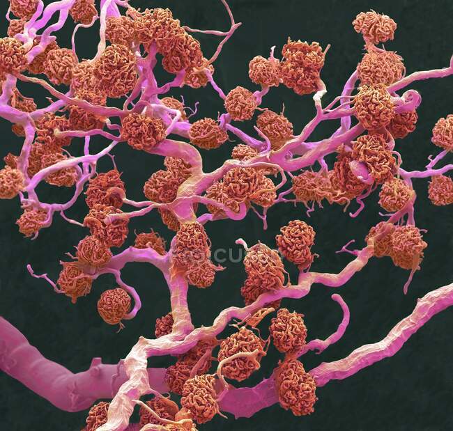 Glomérulos renales. Micrógrafo electrónico de barrido coloreado (SEM) de un molde de resina de glomérulos capilares y los vasos sanguíneos más grandes que les suministran sangre - foto de stock