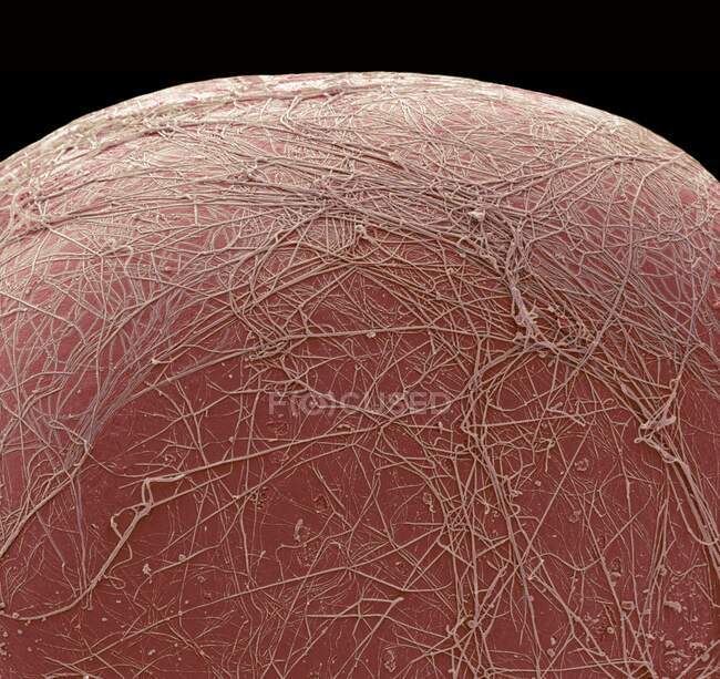 Товста клітина. Кольоровий скануючий електронний мікрограф (SEM) частини жирової клітини (adipocytes). Жирові клітини є одним з найбільших типів клітин людського тіла, кожна клітина має 100 - 120 мікронів у діаметрі. — стокове фото