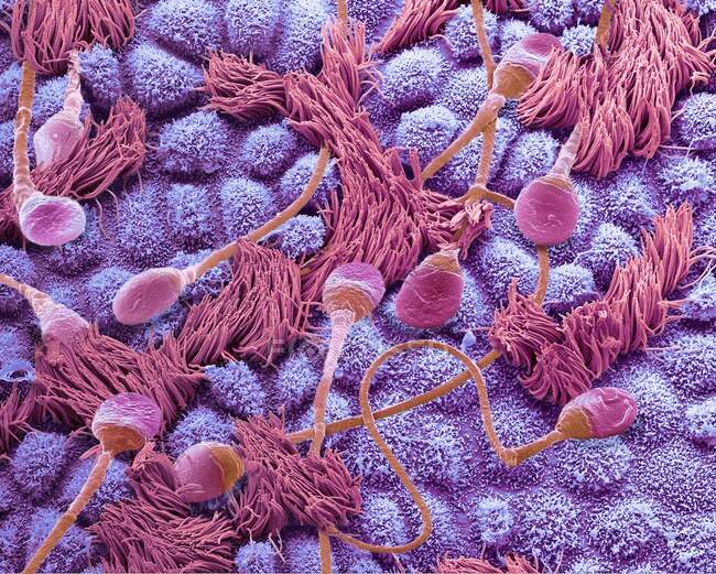 Esperma en una trompa de Falopio. Micrografía electrónica de barrido de composición coloreada (SEM) de esperma humano que viaja a través de una trompa de Falopio (oviducto) de una hembra - foto de stock