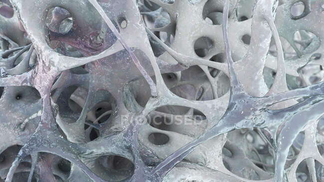 Illustration of bone structure affected by osteoporosis. Thinning of the bone matrix is visible — Stock Photo
