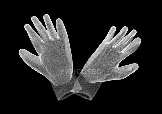 Scrub mitts, X-ray, radiology scan — Stock Photo