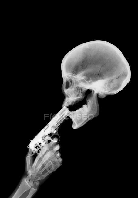 Gun and skeleton, X-ray. — Stock Photo