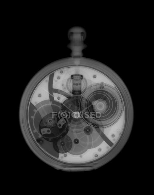 Кишеньковий годинник, рентген, радіологічне сканування — стокове фото