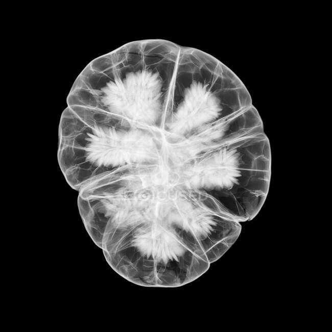 Cabeça de semente, raio-X. — Fotografia de Stock