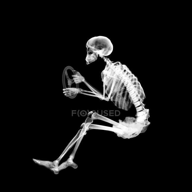 Squelette en position de conduite, rayons X. — Photo de stock