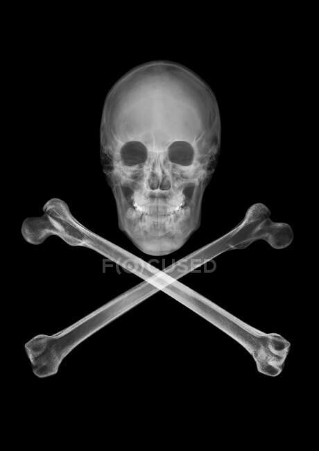 Crâne et os croisés, radiographie. — Photo de stock