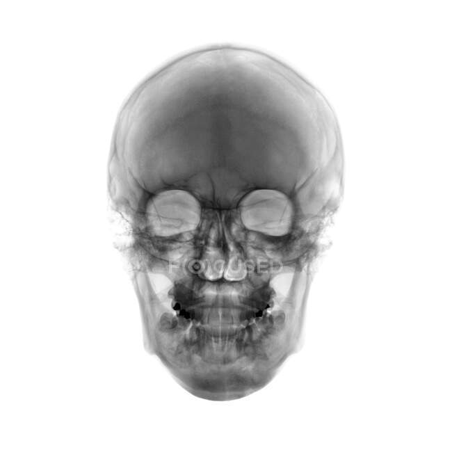 Menschlicher Schädel, Röntgenbild. — Stockfoto