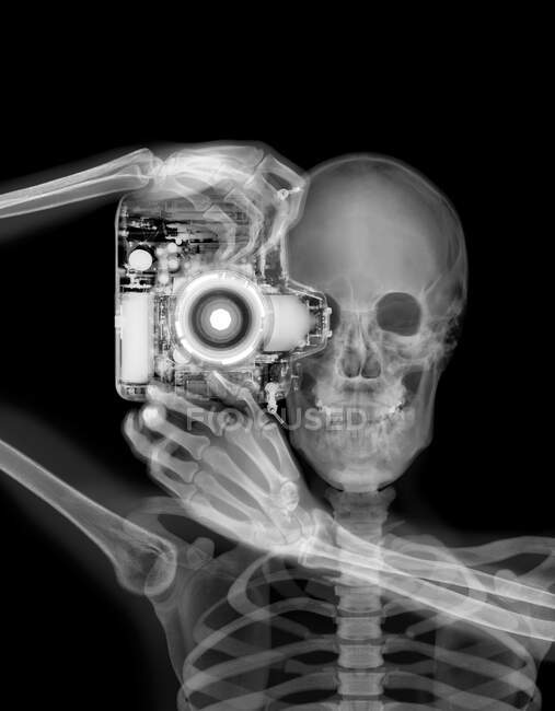 Скелет и камера, рентген — стоковое фото